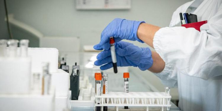 Covid oggi Calabria, 595 contagi e 2 morti: bollettino 2 dicembre