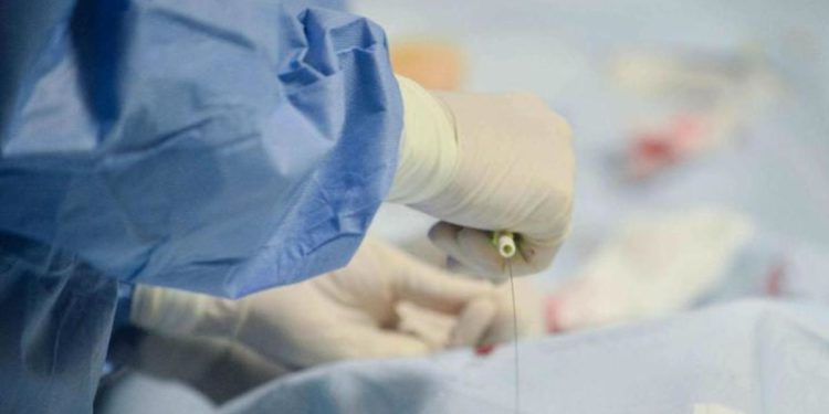 Nasce Intergruppo parlamentare trapianti, aperte adesioni