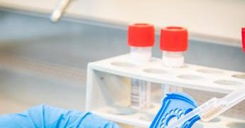 Covid oggi Lazio, 1.323 contagi e 3 morti. A Roma 680 casi