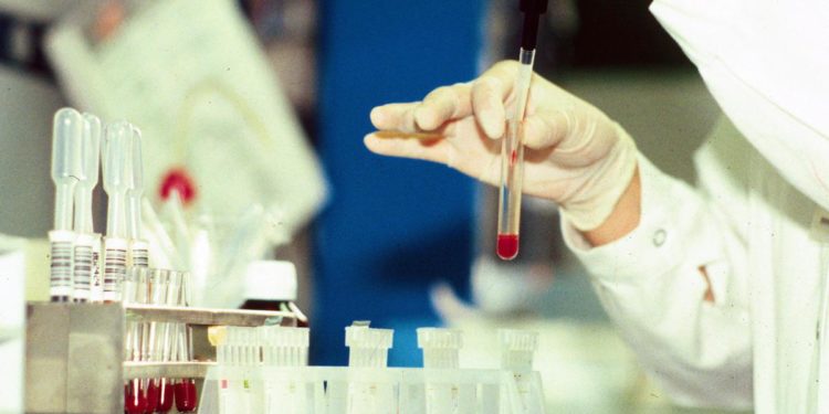 Covid oggi Lazio, 2.245 contagi e 8 morti: a Roma 1.238 casi