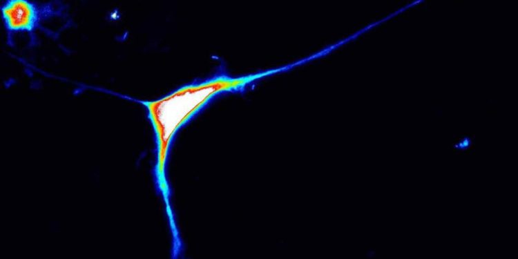 Scoperto un gene che causa l’autismo, è il Caprin1