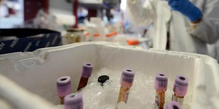 Covid, Oms: 6 varianti sotto osservazione, no prove malattia più grave