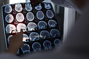 Il 21 giornata mondiale Alzheimer, l’appello ‘illuminiamo i Palazzi di viola’
