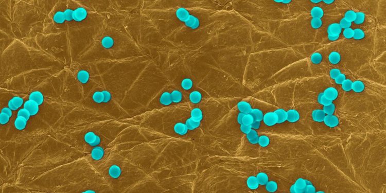 “Super batteri peggio del Covid, ogni anno 5 milioni di morti”