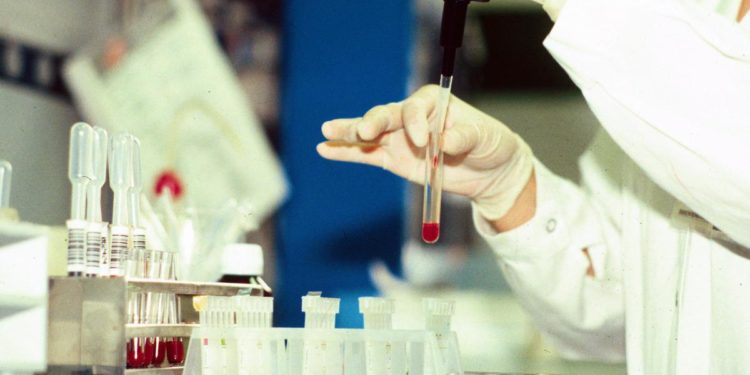 Emofilia A moderata, nuova indicazione in Ue per anticorpo bispecifico