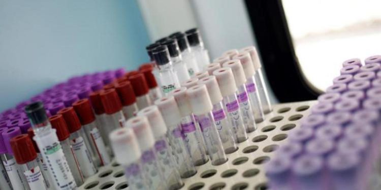 Covid oggi Calabria, 49 contagi e zero morti: bollettino 13 febbraio