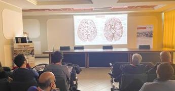 Al Neuromed di Pozzilli addestramento unico in neurochirurgia