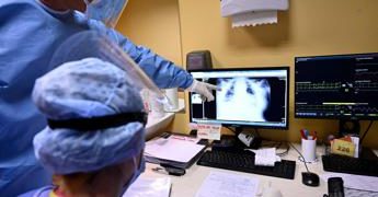 Long Covid pandemia ombra, Oms Europa: “Oltre 200 sintomi, cure su misura”