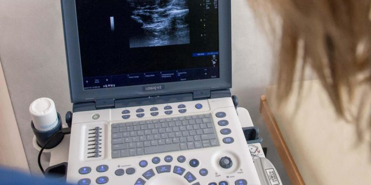 Long Covid raddoppia rischi cuore, lo studio