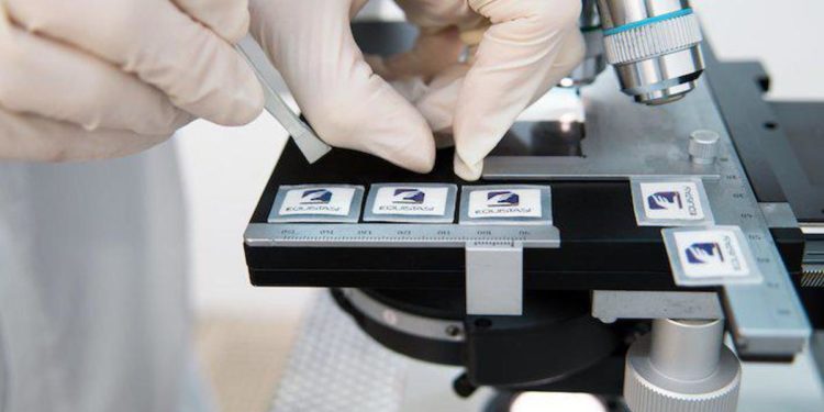 Malattie neurodegenerative, arriva dispositivo nanotech tutto made in Italy