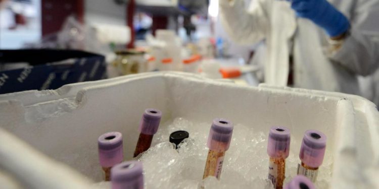 Aviaria, studio italiano su 3 casi umani: “Non sono frutto di salto di specie”