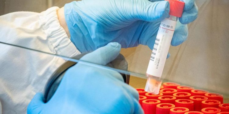 Covid Italia, Iss: Rt sale, ricoveri in calo