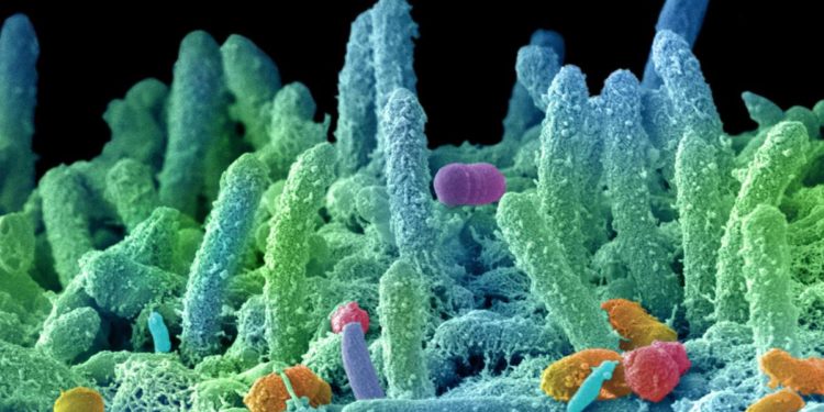 Antibiotico resistenza, Bassetti: “Oltre 80 milioni per finanziare lotta a super batteri”