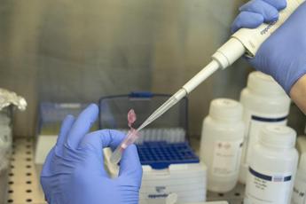 Aids, infettivologo Gori: “Prep non solo farmaco ma strategia anti-virus”