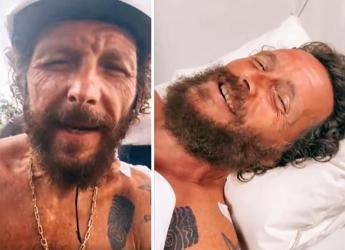 Incidente per Jovanotti, femore rotto e frattura alla clavicola