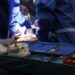 Milano, operato a 3 mesi per una malattia rara del pancreas