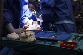 Milano, operato a 3 mesi per una malattia rara del pancreas