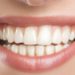 Sorridere attiva gli ormoni ‘dose’ benefici per la salute, oggi World Smile Day