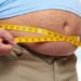 Obesità, Ia prevede quanti chili si perderanno con intervento chirurgico