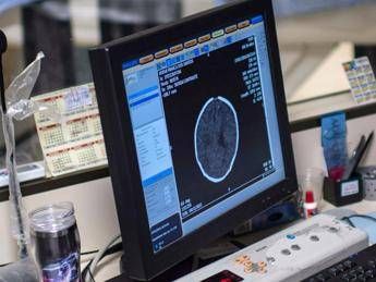 Salute, Padovani (Sin): “Longevità aumenta rischio Alzheimer, agire su prevenzione”