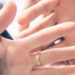 Anello troppo stretto al dito, servono i pompieri