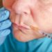 Botox non conosce crisi, anzi: ecco quante ‘punturine’ in un anno in Italia