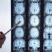 Ricerca, mappati nel cervello i neuroni del linguaggio