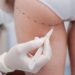 Boom ritocchi ai glutei, il chirurgo: “Richieste in aumento, anche con tecnica fast”