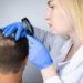 Contributi parrucca e banca dei capelli, il Lazio vicino ai pazienti affetti da alopecia