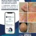 Salute, al via ‘Derma Point’, campagna di prevenzione cheratosi attinica