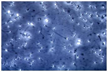 Cercasi sperma uomo non vaccinato contro Covid, boom di richieste sui social