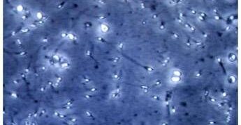 Microplastiche nella prostata e nel liquido seminale, la scoperta italiana: cosa comporta