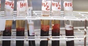 Hiv, Andreoni: “Terapie long acting migliorano aderenza e fermano trasmissione virus”