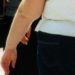 Obesità e cuore stanco, il mix toglie 6 anni di vita