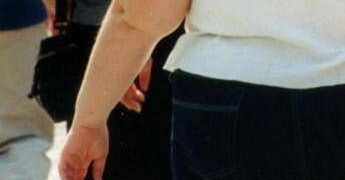 Una morte per malattie infettive su 10 è legata all’obesità, lo studio