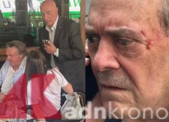 Barillari picchiato da Depardieu in via Veneto: il fotoreporter in ospedale