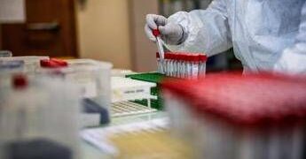 Covid, l’Aspirina frena l’attacco del virus e limita il danno ai polmoni: l’ultimo studio