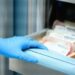 Leucemia linfatica cronica, studio italiano su terapie avanzate per over 80