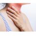 Cambio di stagione: prevenire e curare il mal di gola con semplici rimedi