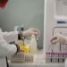 Dengue in Italia, ecco chi dovrebbe sottoporsi a test diagnosi