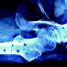 Il 20 ottobre ‘Giornata mondiale dell’osteoporosi’