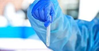 Virus Nipah spaventa l’Asia, Nicastri (Spallanzani): “E’ pericoloso, ma rischio casi d’importazione è virtuale”