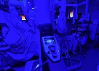 All’Ismett di Palermo bypass aorto coronarico con robot, primo al Sud