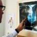 Cancro al seno, crioablazione nuova frontiera di cura