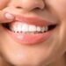 Denti a rischio tra i giovani, Sidp: “Il 36% della Gen Z ha gengive che sanguinano”