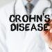 Farmaci, ok Ue per trattamento malattia di Crohn nei pazienti adulti