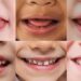 Salute Orale, l’Abc della prevenzione si impara in famiglia