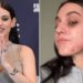 Gaia senza filtri, mostra l’acne sul viso: “Ho pensato di nascondermi, voglio normalizzare”
