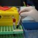 Alzheimer, via libera a test del sangue per diagnosi: cosa significa