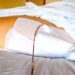 Fine vita, Sin: “Cure palliative fondamentali per pazienti neurologici”